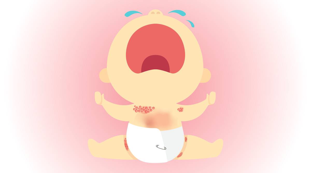 Suzuran Baby Baby Heat rash