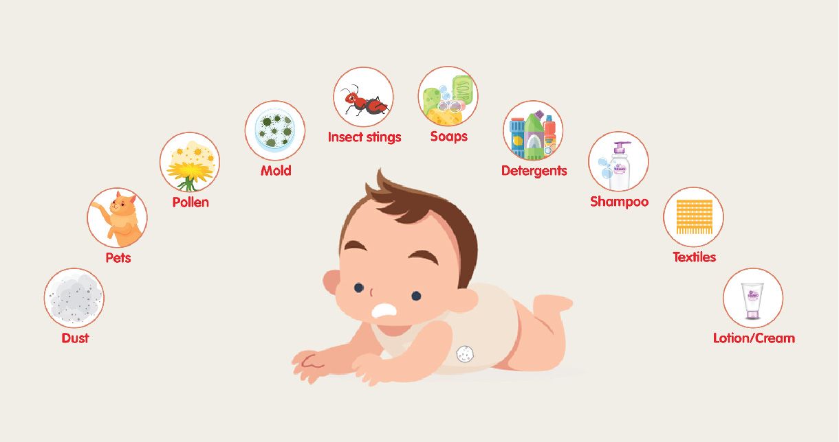 Environmental allergies in newborn baby